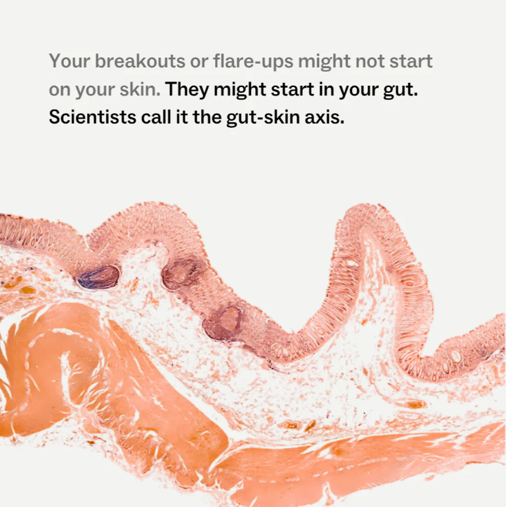 My Way Up || Skin + Gut